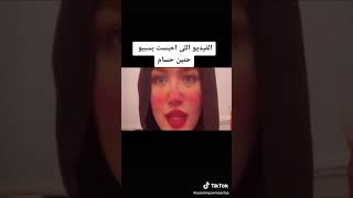 تيك توك حنين حسام️️️️️️️️️️(3)