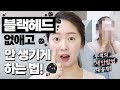 [ENG CC] 블랙헤드 없애고 안 생기는 법ㅣ클렌징 오일 (광고 없음)