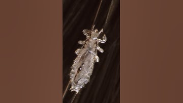 How do we get lice?
