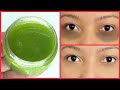 YOU WILL NOT BELIEVE WHAT I USE TO NATURALLY REMOVE MY DARK CIRCLES AND WRINKLES AROUND MY EYES FAST