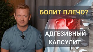 Почему болит плечо? Капсулит. «ЗАМОРОЖЕННОЕ» ПЛЕЧО