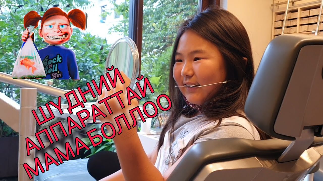 AriNomi Vlog | Nomi шүдний аппарат зүүлээ