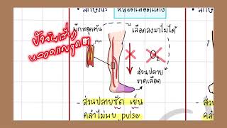 2.4 Vessel   l #เตรียมสอบสภาการพยาบาล #test blue print สภาการพยาบาล #การพยาบาลผู้ใหญ่