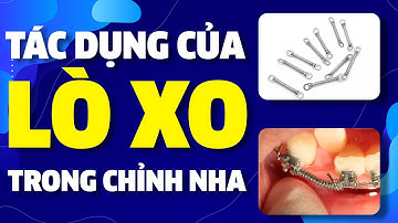Tác Dụng Của Lò Xo Trong Chỉnh Nha | Nam Bùi Vinalign