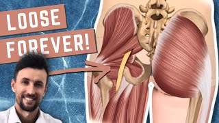 How to Permanently Loosen a Tight Sciatic Nerve