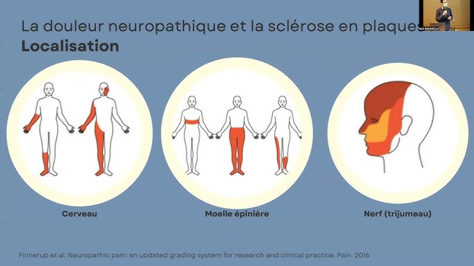 Mon Parcours Santé SEP - YouTube