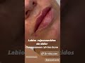 LABIOS naturales jugosos aumento hidratación sin dolor ГУБЫ аугментация увеличение губ без боли