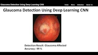 Glaucoma Detection Using Deep Learning CNN | Glaucoma Classification Using Python Project SourceCode