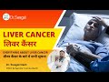 Symptoms of liver cancer i caues diagnosis prevention  treatment of liver cancer i dr swagat