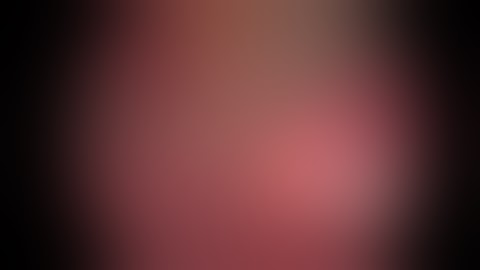 Thoracoscopic segmental lung resection for pulmonary sequestration