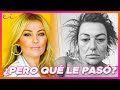 ¿ELLA ES AMAIA MONTERO? Dermatólogo Analiza el increíble cambio de Piel de la Famosa