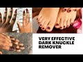 Very effective dark knuckle remover