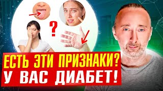 Сахарный Диабет: 12 Первых Признаков! 4 Анализа. Как Вылечить Диабет 2 Типа Навсегда?