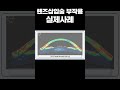 렌즈삽입술 부작용 ❗️실제사례❗️ #shorts #렌즈삽입술 #icl