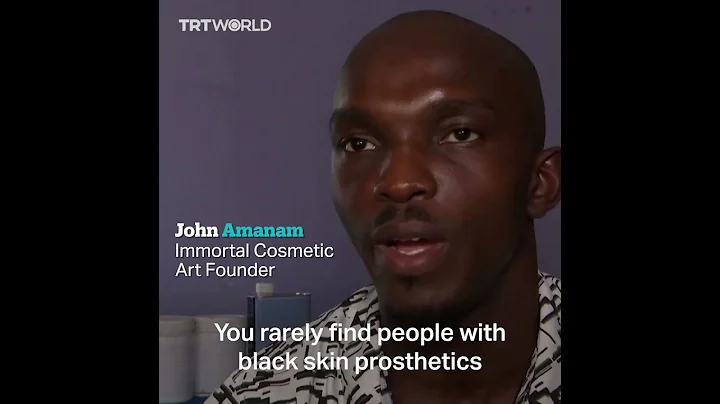 Nigerian artist makes prosthetics for amputees with dark skin tones