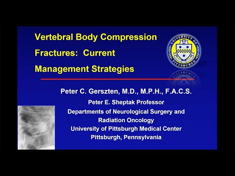 Peter Gerszten Discusses Vertebral Body Compression Fractures