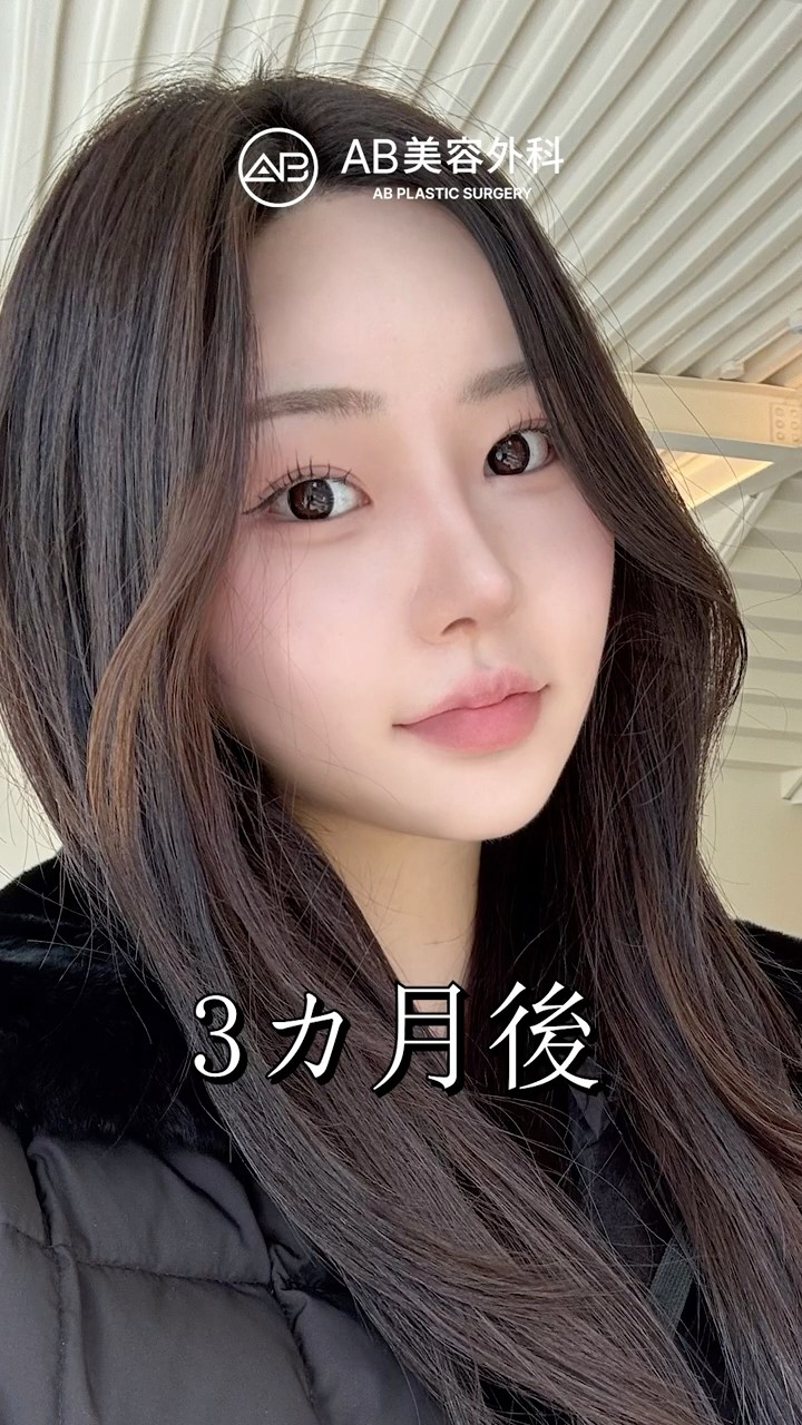 男性的だった顔が、女性らしい印象に変わった #shorts