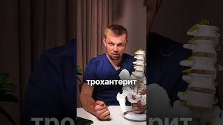 Боль в суставе. Трохантерит или артроз. #артрозсуставов