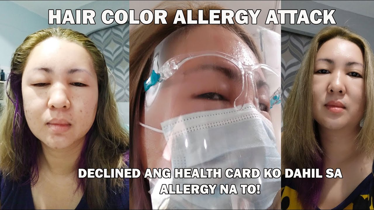 HAIR COLOR ALLERGY ATTACK TIPS PANO GAMUTIN FIRST AIDE NA DAPAT