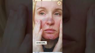 Mumbai heat is no joke right now ☀️🔥| Dr Shikhar Chaube | Dermatologist &amp; Trichologist | Skin doctor