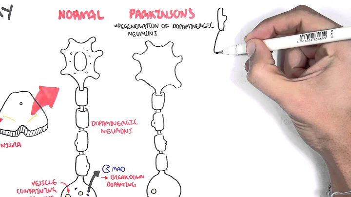 Pharmacology - Parkinson's Disease - DayDayNews