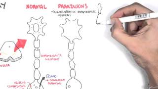 Pharmacology - Parkinson's Disease
