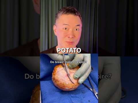 What Happens When Implants Go Wrong