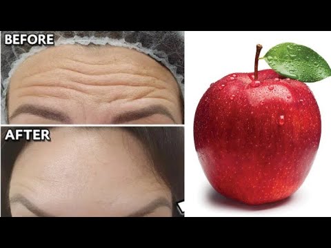 1 apple is a million times stronger than Botox, it eliminates wrinkles and fine lines