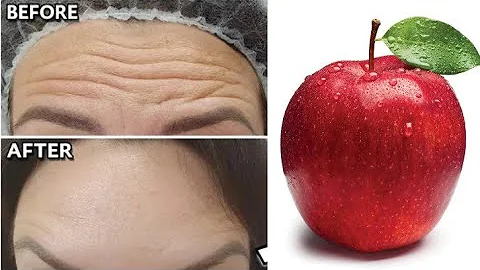 Co způsobuje krůtí krku?