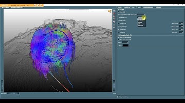 Pre-surgery tool MeVisLab TU Delft