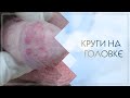 💣 Круги на головке. Клинический случай №31