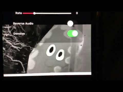 Hello Haahoos In Slow Motion Black And White