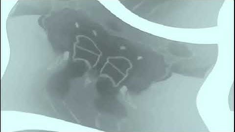 The Real 763 Render Pack Round 1376 Radioup V64