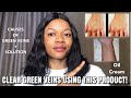 How to get rid of GREEN VEINS, SPIDER VEINS + Causes of Green veins + Best Results + Anniversary ✨