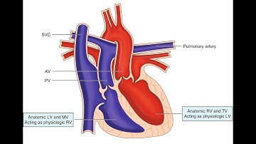 Arterial Transposition CPT code - simplify medical coding