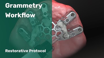 Grammetry Restorative Dental Workflow