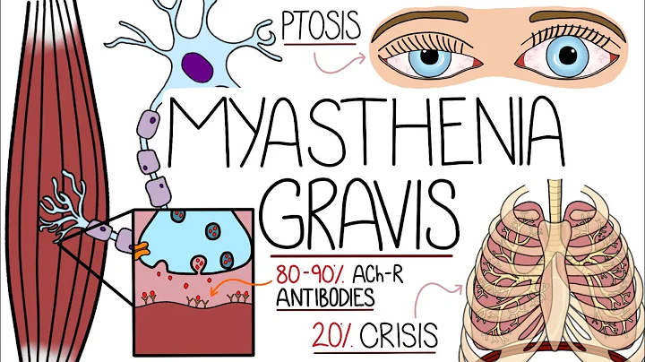 Myasthenia Gravis Explained Clearly