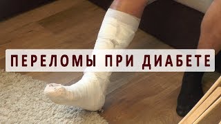 Особенности заживления переломов при диабете Особенности заживления переломов при диабете