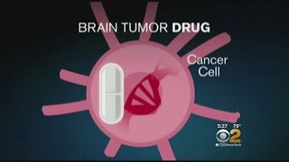 Dr. Max Gomez: Brain Tumor Vaccine