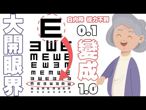 媽媽有白內障 想看電視卻看不到  |飛秒白內障|原本視力不到0.1 術後變成1.0羅育倫醫師專業手術建議 讓張媽媽很開心