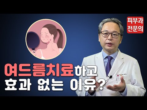 여드름치료하고 효과 없는 이유? [피부, 여드름 없이 깨끗하게 하려면?]