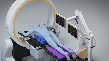 Brainlab Loop X Mobil Robotik Görüntüleme