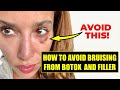 How to prevent bruising from botox and filler do this before you get facial injections