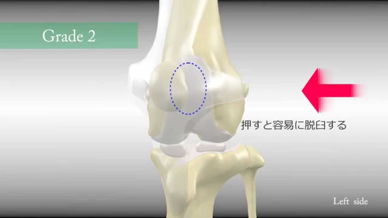 3 パテラ グレード パテラとは？膝蓋骨脱臼(パテラ)になった愛犬の体験談と生活上の注意点