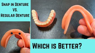 Why a lower snap in denture is better than a lower regular denture
