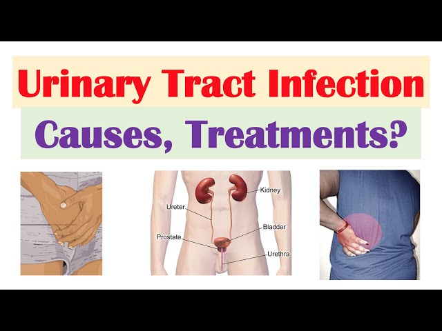 Urinary Tract Infection (UTI) - Symptoms & Treatment Options