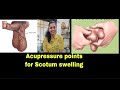 Acupressure points for scrotal swelling  hydrocele