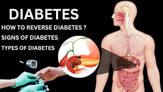 Diabetes | Diabetes Symptoms | Diabetes Control Tips | Diabetes Diet | Urdu/Hindi | 3D Animation