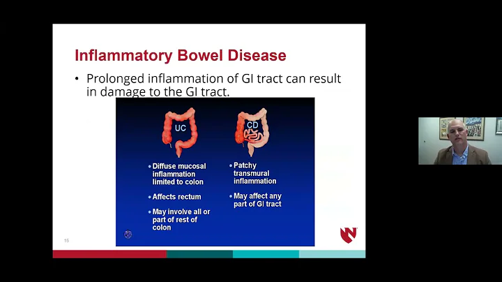 Advancing Health Webinar: IBD vs  IBS