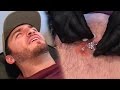 REMOVING MY INFECTED PIERCING!!